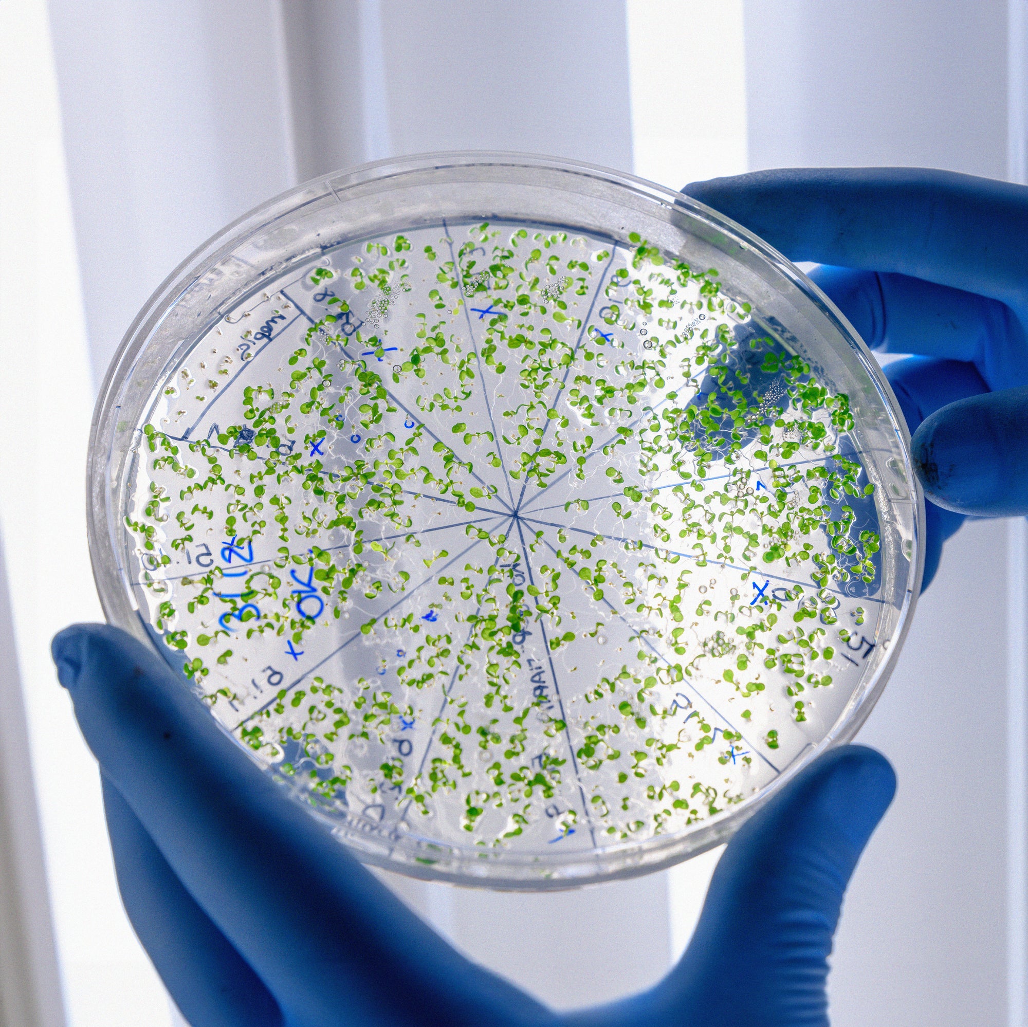 La sorprendente relación entre la microbiota y las enfermedades autoinmunes