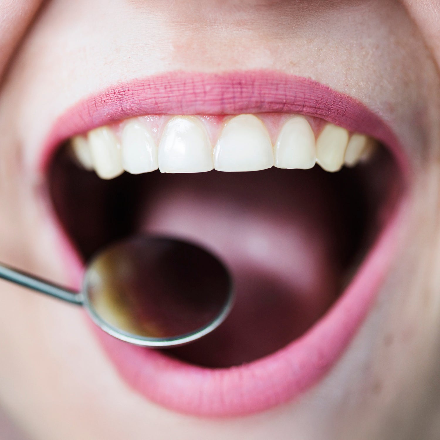 Microbiota oral: guardián de tu sonrisa